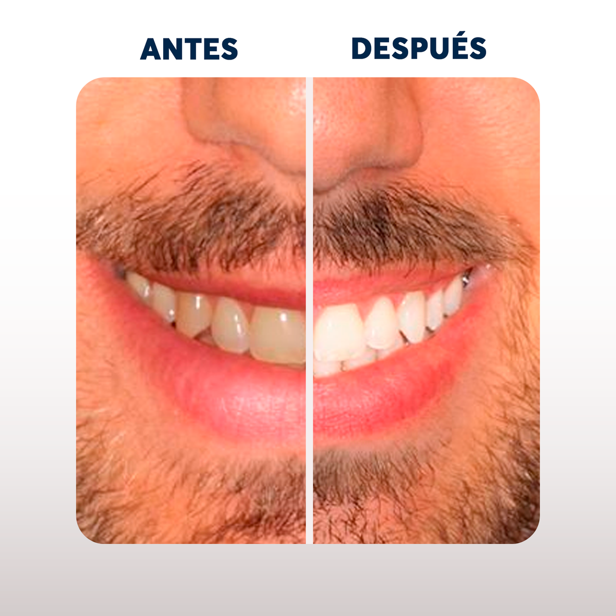 2x1 Carbon Activado Envase Ecologico + Cepillo Bambú de Regalo