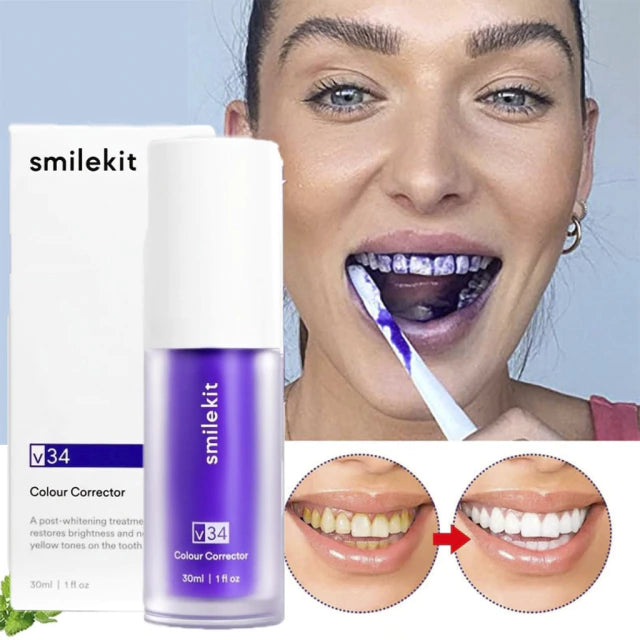 SmileKit V34 - Tus dientes más blancos